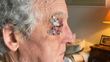 Aggression à Créteil: Pierre et d'autres victimes poussées dans le lac