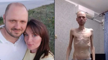 Transformation de Volodymyr Tsema-Bursov après 20 mois de captivité en Russie