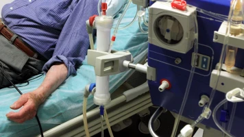 Associations de malades chroniques expriment inquiétudes sur l'ALD