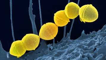 Augmentation alarmante des infections à streptocoque au Japon
