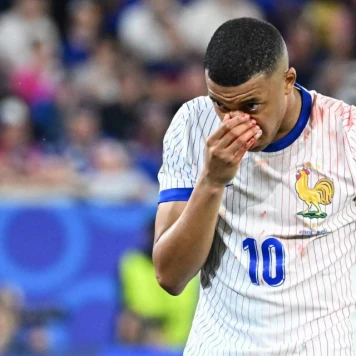 Kylian Mbappé Blessé, Remplacé par Giroud - Dernières Nouvelles Euro 2024
