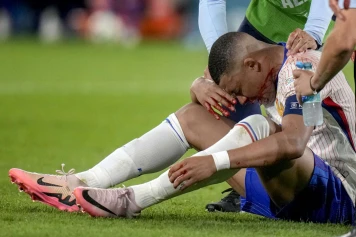 Les Bleus démontrent leur force malgré les troubles, Mbappé incertain
