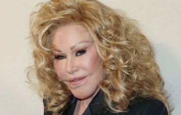 Décès de Jocelyn Wildenstein, la Femme Chat : Une Vie de Controverses et de Chirurgie Esthétique
