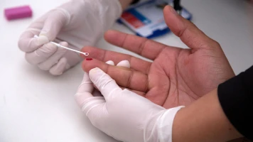 Une Femme de 60 Ans Pourrait Devenir la Première Guérie du VIH en France