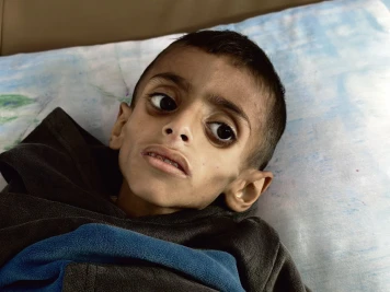 Gaza : 72 jours de famine orchestrée par Israël