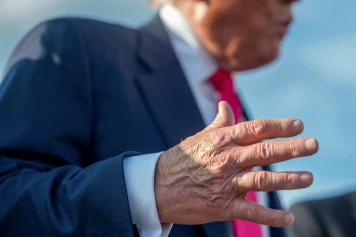 État de santé de Donald Trump : Insuffisance veineuse chronique révélée