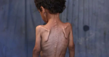 Gaza : L'urgence humanitaire et la nécessité d'une mobilisation internationale
