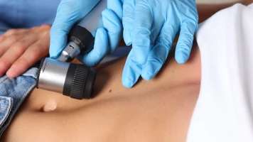 « Une avancée extraordinaire » : le vaccin à ARN messager contre le cancer de la peau, le début d’une révolution médicale ?